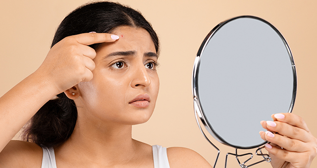 Best Skin Care Routine for Pimple-Prone Skin